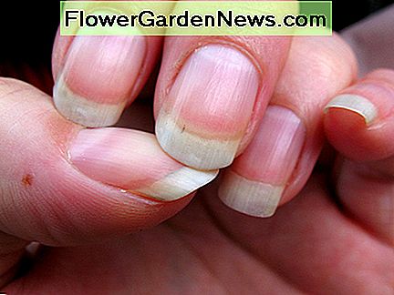 nagelband Cuticles