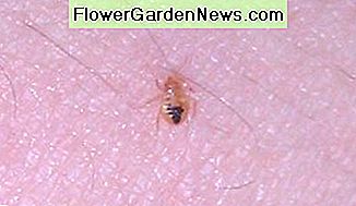 Tamsi kūno dalis mums sako, kad ši kūdikio gulbė pradėjo valgyti. The dark portion of the body tells us that this baby bed bug has started a meal.