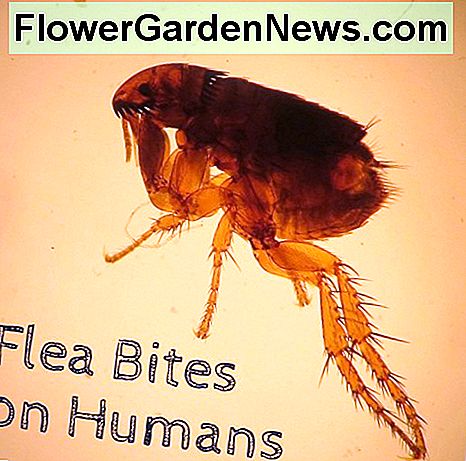Flea Bites on Humans: Symptoms and Treatment